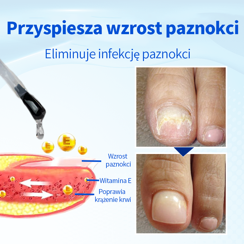 Ropceer™ OnyxoGuard Paznokcie Wzrost i Regeneracja Serum
