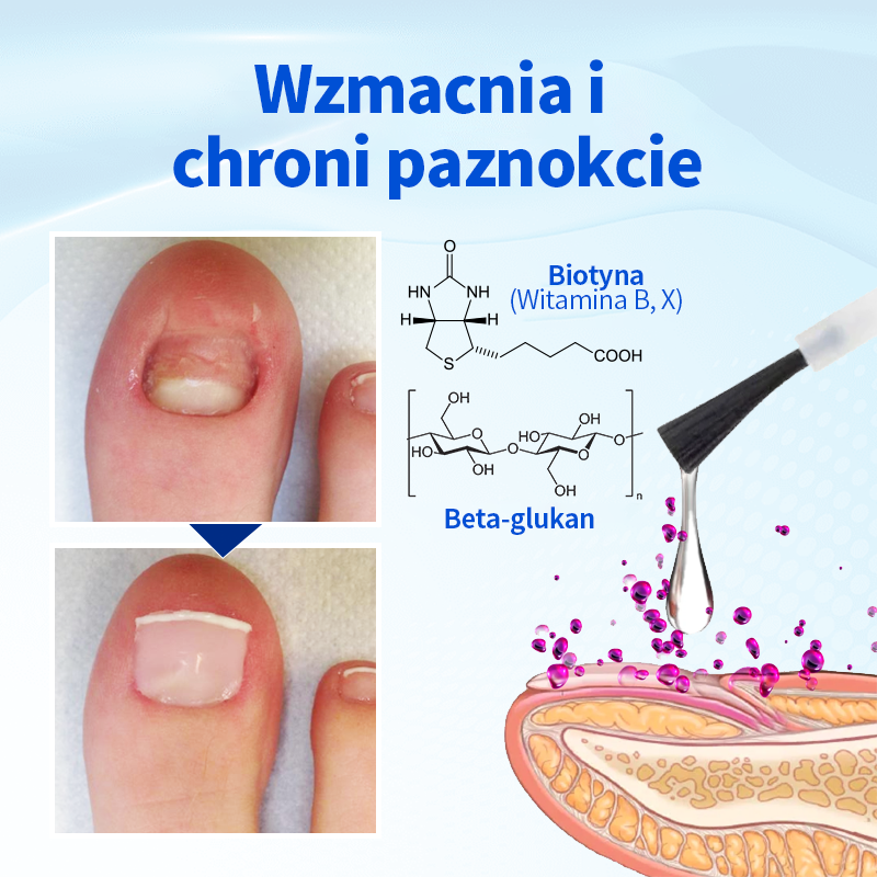 Ropceer™ OnyxoGuard Paznokcie Wzrost i Regeneracja Serum