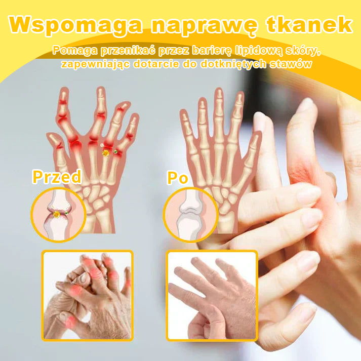 Ropceer™ Krem przeciwbólowy na bazie toksyny botulinowej i jadu pszczelego, wspomagający gojenie kości
