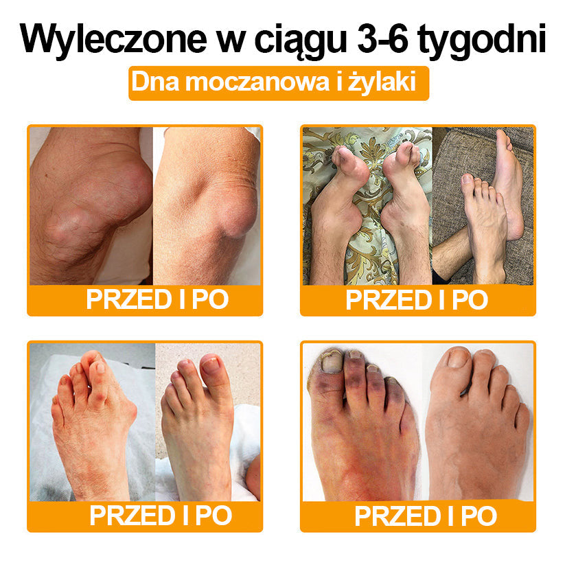 Ropceer™ Krem przeciwbólowy na bazie toksyny botulinowej i jadu pszczelego, wspomagający gojenie kości