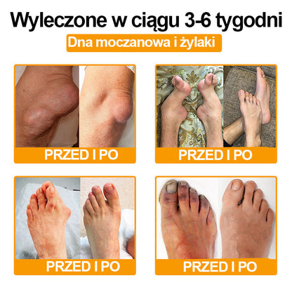 Ropceer™ Krem przeciwbólowy na bazie toksyny botulinowej i jadu pszczelego, wspomagający gojenie kości
