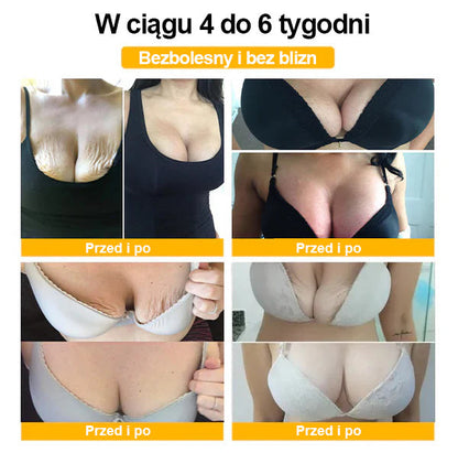 𝗖𝘃𝗿𝗲𝗼𝘇™👠 ROYAL JELLY PLASTER NA POWIEKSZENIE PIERSI  🌟Ograniczony czas 80% zniżki