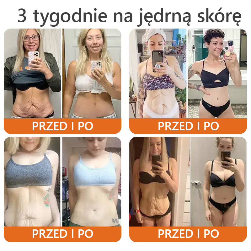 Oficjalny sklep: ✅Wyprodukowano i wysłano z PL✨Turonu™ Botox Bee Venom Firming Serum Stick(🔥OSTATNI DZIEŃ 70% ZNIŻKI)👩‍⚕️