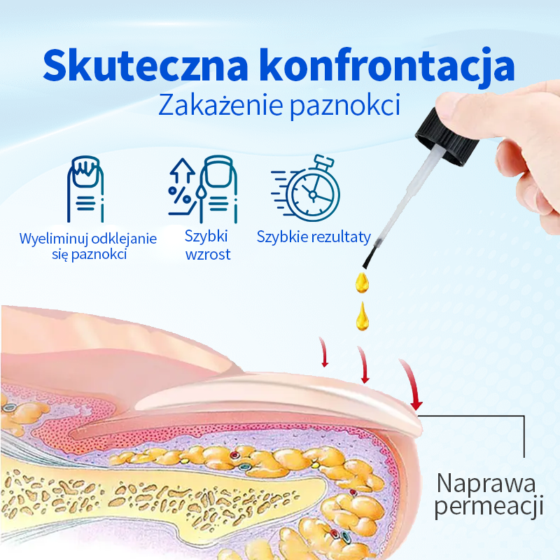 Ropceer™ OnyxoGuard Paznokcie Wzrost i Regeneracja Serum