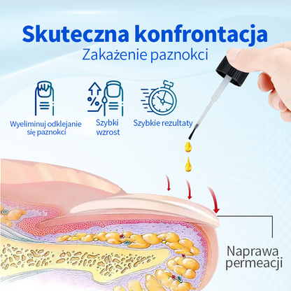 Ropceer™ OnyxoGuard Paznokcie Wzrost i Regeneracja Serum
