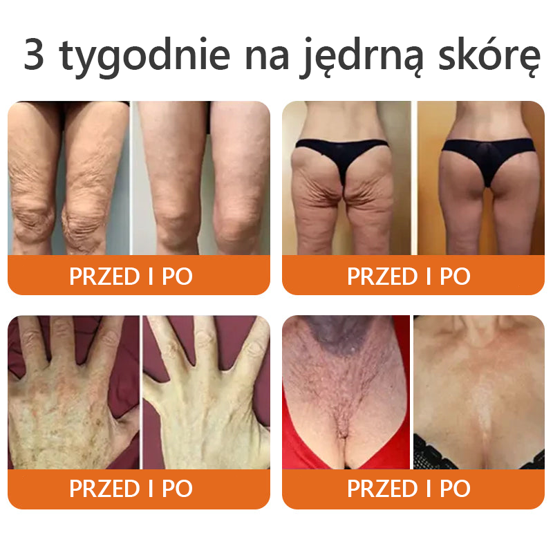 Oficjalny sklep: ✅Wyprodukowano i wysłano z PL✨Turonu™ Botox Bee Venom Firming Serum Stick(🔥OSTATNI DZIEŃ 70% ZNIŻKI)👩‍⚕️