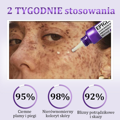 🩷✅ Certyfikacja NFZ| Ropceer® 𝐄𝐏𝐈𝐆𝐋𝐎𝐖 𝐌𝐞𝐥𝐚𝐧𝐄𝐗 Krem do twarzy premium