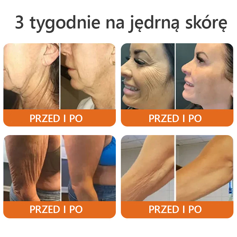 Oficjalny sklep: ✅Wyprodukowano i wysłano z PL✨Turonu™ Botox Bee Venom Firming Serum Stick(🔥OSTATNI DZIEŃ 70% ZNIŻKI)👩‍⚕️