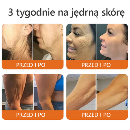 Oficjalny sklep: ✅Wyprodukowano i wysłano z PL✨Turonu™ Botox Bee Venom Firming Serum Stick(🔥OSTATNI DZIEŃ 70% ZNIŻKI)👩‍⚕️
