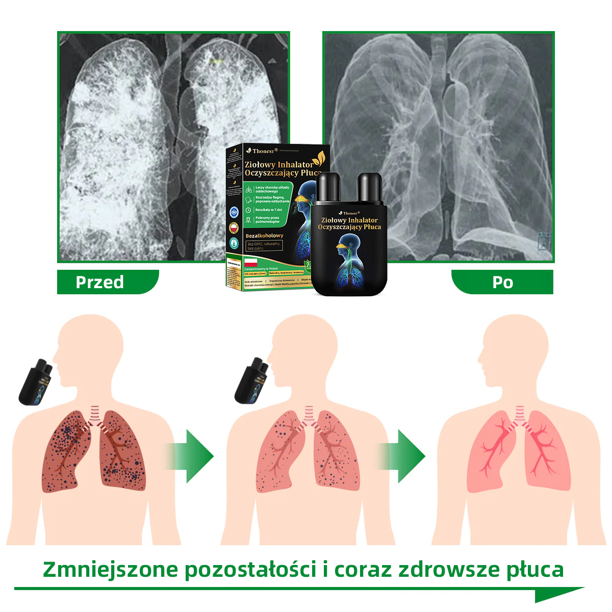 Oficjalny sklep💝✅:Thonesr® Ziołowy Inhalator Oczyszczający Płuca  🫁Zatwierdzony przez URPL(💝 kaszel, świszczący oddech, duszność, plwocina, zatkany nos, zapalenie oskrzeli, zapalenie oskrzeli, objawy alergii, dyskomfort w płucach💝)👨‍⚕️